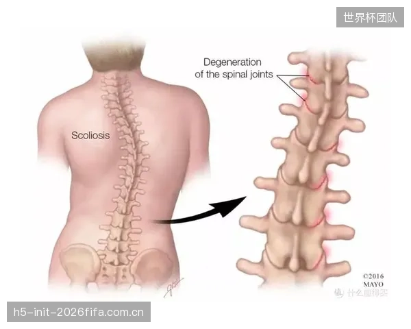 闭环纠偏技术将催生针对青少年脊柱侧弯和老年肌力衰退的细分市场 闭环纠偏技术将催生针对青少年脊柱侧弯和老年肌力衰退的细分市场